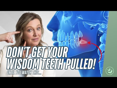 WARNING: The Hidden Dangers of Getting Wisdom Teeth Pulled
