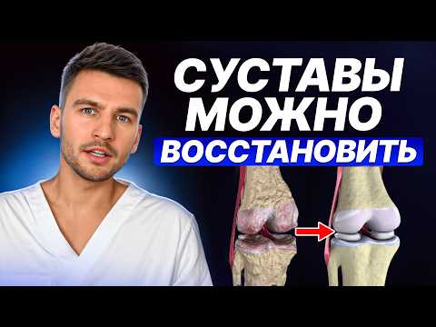 Об этом НЕ ГОВОРЯТ врачи! ВСЕ способы ЛЕЧЕНИЯ артроза: что работает, а что тратит деньги и время?