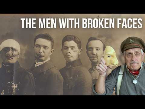 Transforming Faces | World War 1 and the birth of modern plastic surgery