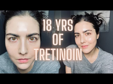 Not Seeing Results with Retin-A (TRETINOIN)? Watch This Before You Quit & Avoid My Biggest Mistake