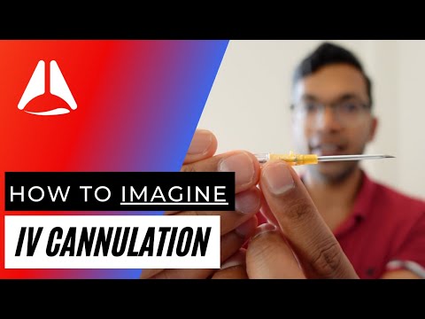 How to imagine IV (intravenous) cannulation - my attempt at drawing on IPAD/notability