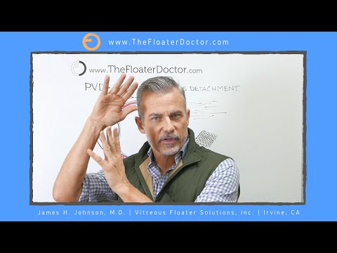 EYE FLASHES & POSTERIOR VITREOUS DETACHMENT. Risks of Retina detachment & new vitreous eye floaters