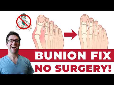 How to Fix Bunions at Home! [Bunion Pads? Splints? Insoles? Shoes?]
