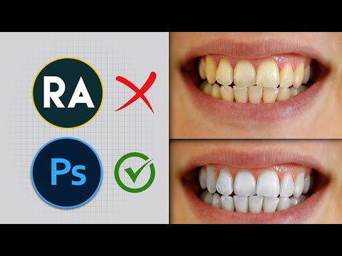 Comment blanchir les dents sur Photoshop Rapidement ?