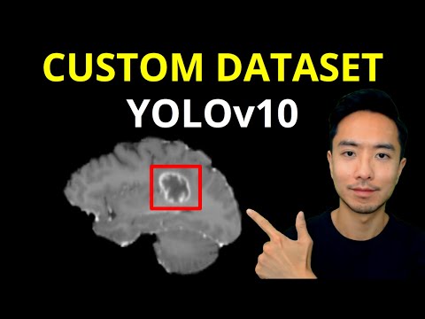YOLOv10 Custom Dataset Training Object Detection Brain Tumors