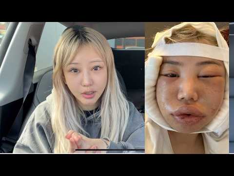 I Spent Over 100K on plastic surgeries, so you don't have to (seriously don't)