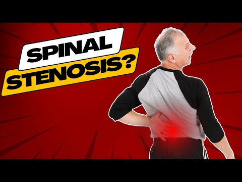 Top 3 Symptoms of Spinal Stenosis