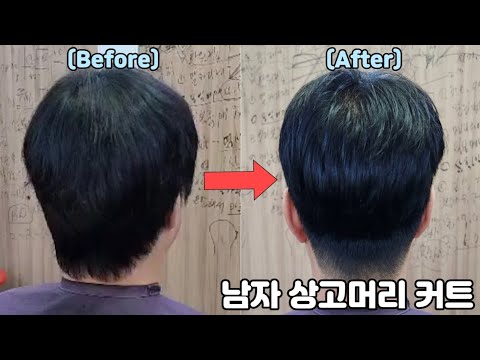 남자상고 /사람시술