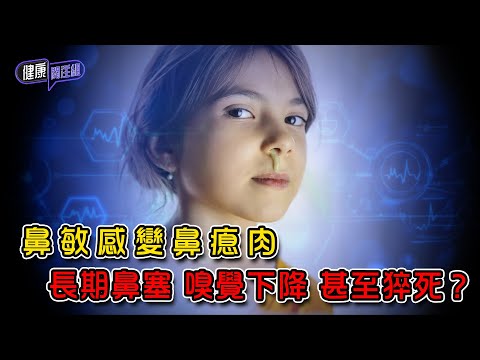 鼻敏感變鼻瘜肉 長期鼻塞 嗅覺下降 甚至猝死？｜ 健康關注組 ｜ EP346 ｜ 鼻瘜肉 ｜ 鼻敏感 ｜ 敖嘉年 ｜ 朱智賢 ｜ HOY TV 77台