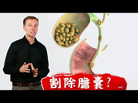 (結石2) 膽結石要割除膽囊嗎？ 膽結石原因？吃什麼飲食溶解結石？柏格醫生dr berg