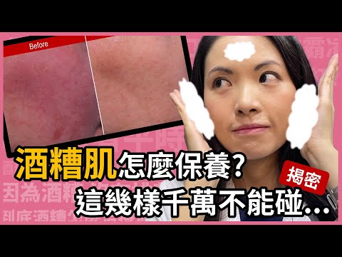 酒糟肌可以化妝嗎?平時應該如何保養?那些保養品是地雷不能碰?就讓林昀萱醫師來幫你分析吧!