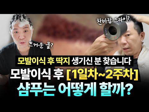 모발이식 후 샴푸 어떻게 하나요? (2025ver)이식모 빠지지 않으려면....[ENG CN JP SUB]