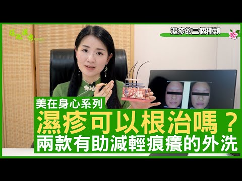 濕疹可以根治嗎？ 兩款有助減輕痕癢的外洗 鄭丹瑞《健康旦》註冊中醫師 #楊明霞 EP 13 Part 1 (CC中文字幕)