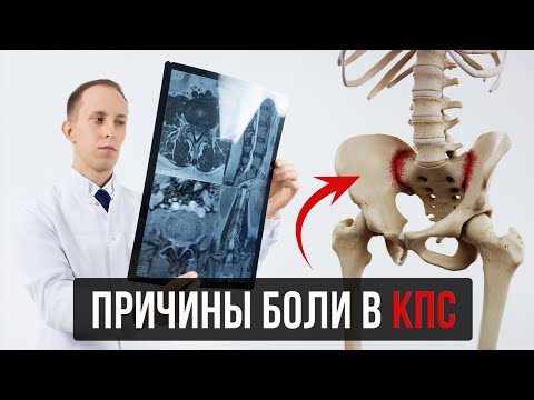 Боль из крестцово-подвздошного сустава (КПС): лучшие практики диагностики и лечения