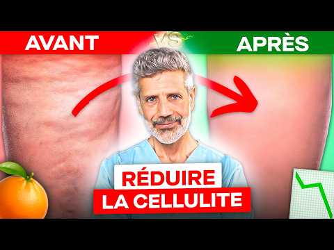 10 Conseils Pour en Finir Avec la Cellulite en 2 Mois