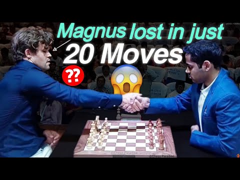 Magnus Lost in Just 20 Moves — Unbelievable! 😱