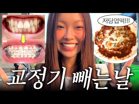 Finally getting my braces off...🥵 Vlog of me going wild with my braces off🦷💥 (+Retainer review^^....