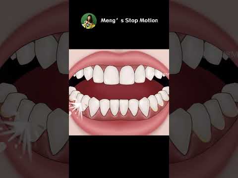 ASMR Animation | Water Flosser for Teeth! Remove Heavy Tartar! | Meng's Stop Motion