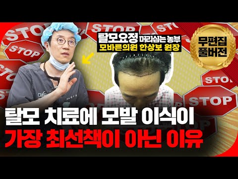 🚨모발이식 받기 전, 꼭 이 영상 보고 가세요! 생각이 달라질 수도 있습니다! 모발이식은 차선책으로 신중하게 하세요!🚨 [의사결정 ep.47 Full Ver.]