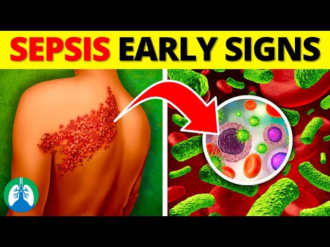 Top 10 Early Warning Signs of Sepsis | NEVER Ignore THIS