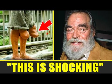 15 Golden Age Stars With the WEIRDEST Body Parts