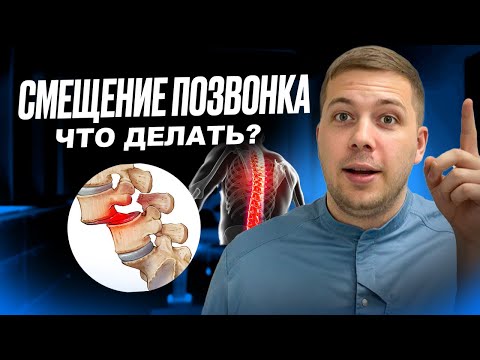 СПОНДИЛОЛИСТЕЗ. Что такое НАСТОЯЩЕЕ смещение позвонка? Что с этим делать?