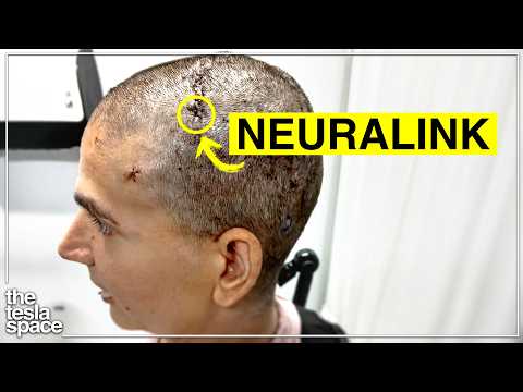 Neuralink Reveals First Female Patient