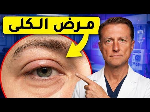 إشارات يرسلها جسدك قبل أن تتلف الكلى تمامًا