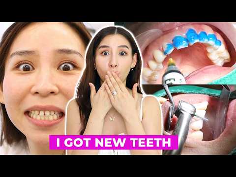 I Got a Dental Makeover in Korea 😬 🦷