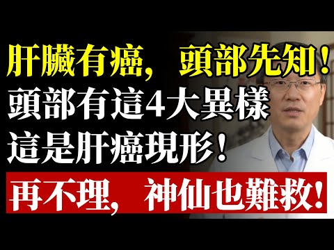 肝癌來時，“頭部”竟會提前“拉警報”？醫生鄭重警告：頭部4大“反常變化”，竟是肝硬化、肝癌在“求饒”！再不看懂，神仙也難救#健康#養生#肝癌#肝臟#肝硬化#黃疸#早期發現#預防醫學#黃麴霉素#癌症徵兆