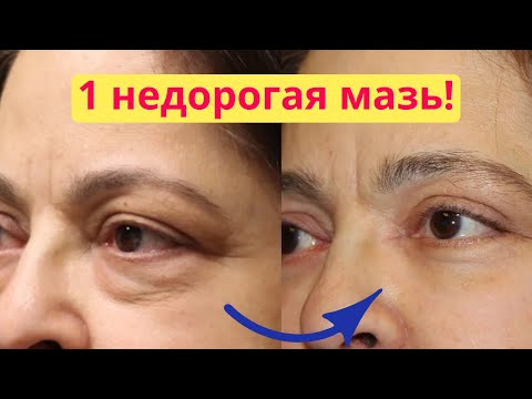 ONLY 1 ointment! How to remove bags under the eyes, wrinkles under the eyes, swelling of the eyel...