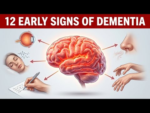 Top Neurologist Reveals Early Warning Signs of Dementia