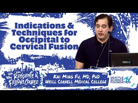 Indications & Techniques for Occipital to Cervical Fusion - Kai Ming Fu, MD, PhD