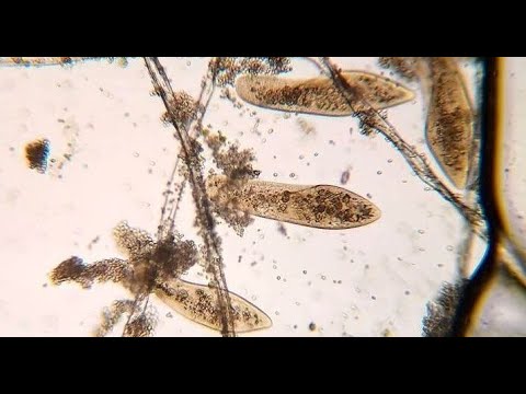 Как выбрать Микроскоп? И что с ним потом делать?