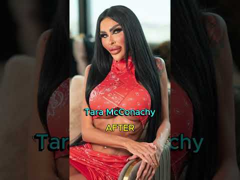 #shorts#celebrity# cosmetic surgery#hollywoodicons