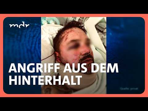 Mann am Bahnhof Wurzen nach Fußballspiel brutal niedergeschlagen | Kripo live | MDR