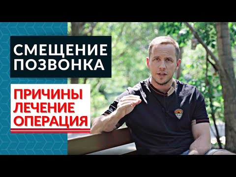 Всё про СПОНДИЛОЛИСТЕЗ. Когда нужна операция?