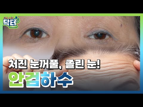안검하수 수술과 쌍꺼풀 수술은 같다? 안검하수의 모든 것!｜ 온에어 닥터스