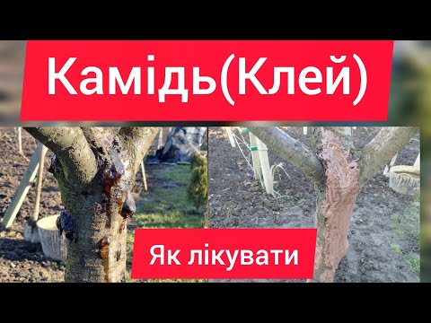 Камідь.Як рішити проблему.Покрокова інструкція.