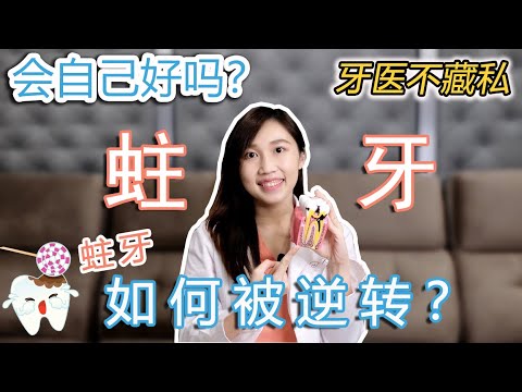 Ways to Stop Cavities and Reverse the Early Tooth Decay l Dentist Explained