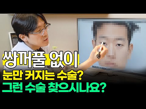 눈성형ㅣ쌍꺼풀 안 생기고 눈만 커질 수 있을까요? 무쌍과 속쌍(ENG)