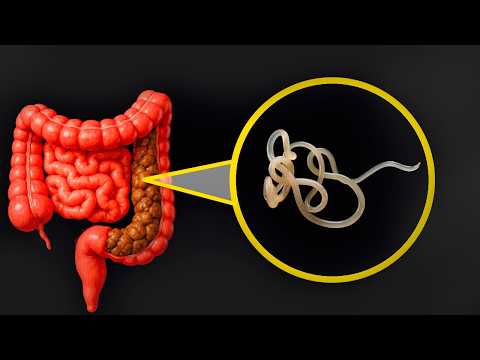 Secret remedy for parasites: Find it in your kitchen!