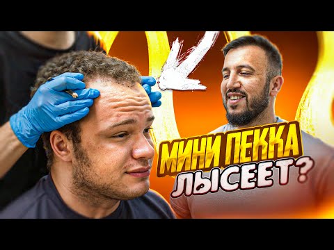 ЗАЧЕМ МИНИ ПЕККЕ ПЕРЕСАДКА ВОЛОС?