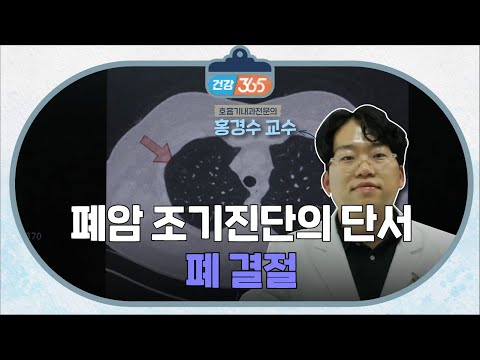 폐암 조기진단의 단서ㅣ폐 결절ㅣ홍경수 교수 [TBC클리닉건강365]