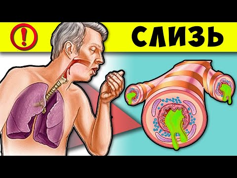 Моментально рассосёт Слизь и Мокроту! Простые методы спасут Бронхи и Горло...
