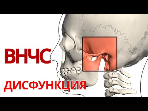 ДИСФУНКЦИЯ ВНЧС | 6 причин хруста и боли в ВНЧС. Диагностика. Лечение.