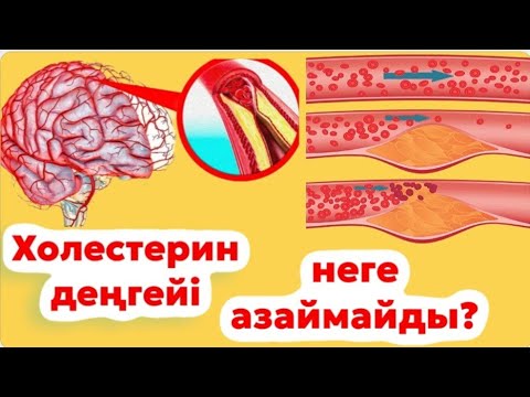 ХОЛЕСТЕРИНді қалай азайтамыз.ИНСУЛЬТ пен ИНФАРКТАН сақтан 💪💪