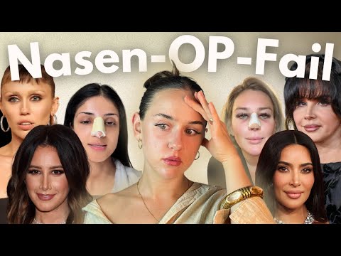 Wie Nasen-OPs Gesichter (und Leben) zerstören können