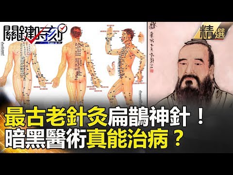 關鍵時刻精選│最古老針灸扁鵲神針！暗黑醫術真能治病？- 朱學恒 劉燦榮 馬西屏 王瑞德