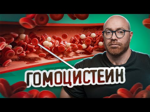 КАК ГОМОЦИСТЕИН МОЖЕТ УГРОБИТЬ ВАШ ОРГАНИЗМ?